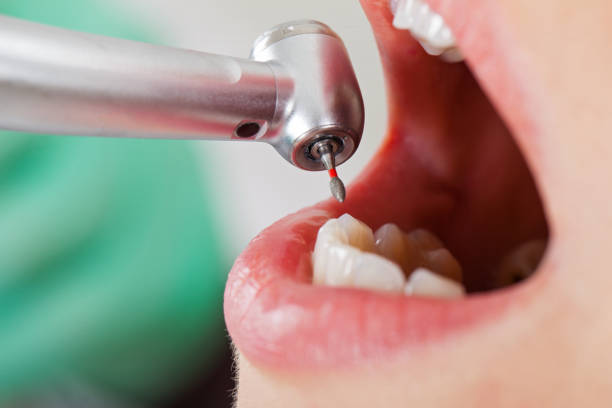 Best Emergency Denture Repair in Clayton, IN